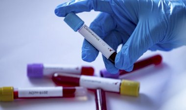 KORONAVİRÜSLÜYÜM DİYEREK POLİSE TÜKÜRMÜŞTÜ. 26 HAFTA HAPİS  CEZASI VERİLDİ