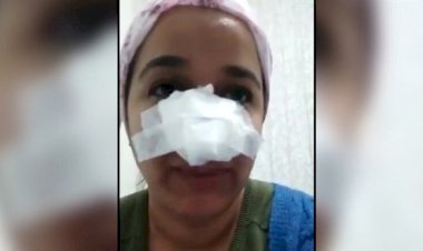 UZMAN ÇAVUŞ'UN DARP OLAYINDA BAŞSAVCILIK: HERHANGİ BİR KEMİK KIRIĞI YOK