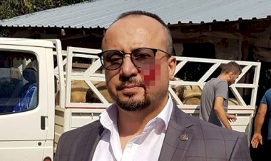 HACZE GELEN AVUKATIN YANAĞINI ISIRDI, 2,5 YIL HAPİS CEZASI ALDI!