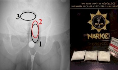 ANÜSÜNDEN UYUŞTURUCU ÇIKTI