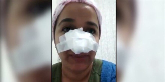 UZMAN ÇAVUŞ'UN DARP OLAYINDA BAŞSAVCILIK: HERHANGİ BİR KEMİK KIRIĞI YOK