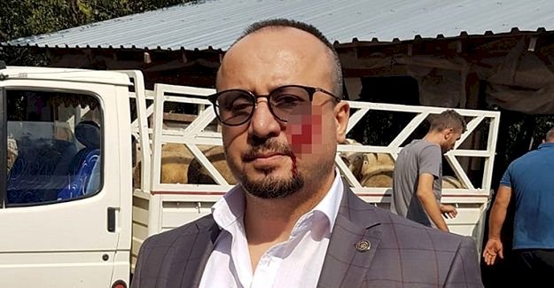 HACZE GELEN AVUKATIN YANAĞINI ISIRDI, 2,5 YIL HAPİS CEZASI ALDI!