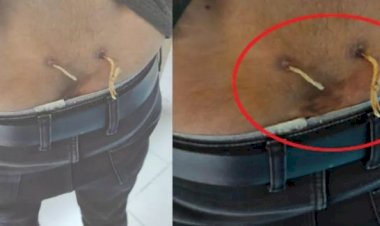 'ALTERNATİF TIP' ADI ALTINDA YAPILAN İŞKENCEDE SON NOKTA: ÇAMAŞIR İPİYLE BEL TEDAVİSİ!