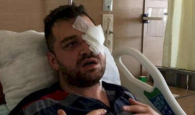 AVUKATI BIÇAKLAYARAK BİR GÖZÜNÜ KAYBETMESİNE NEDEN OLAN SANIĞA 18 YIL HAPİS